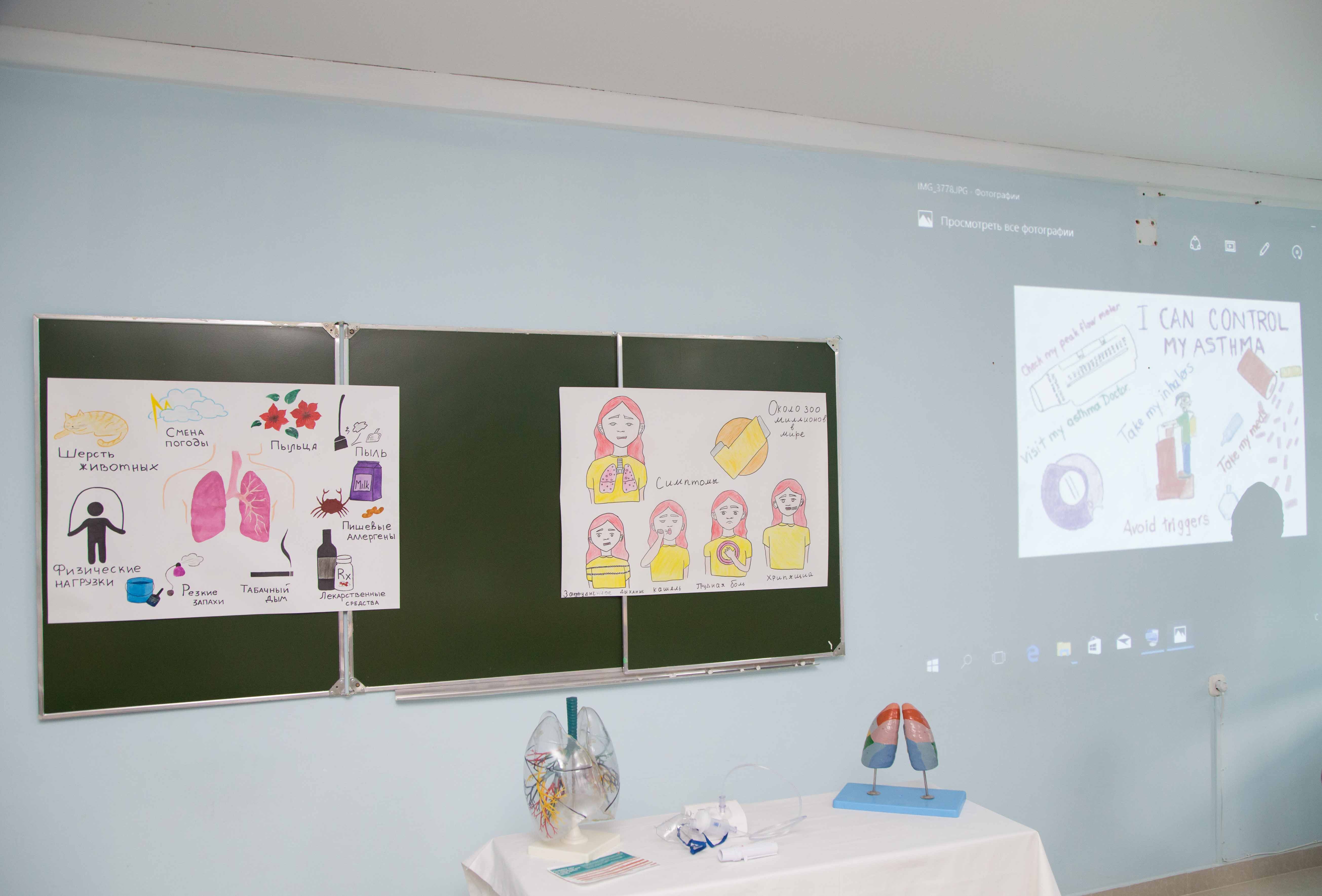 "Бронхиальная астма", ее симптомы и причины болезни